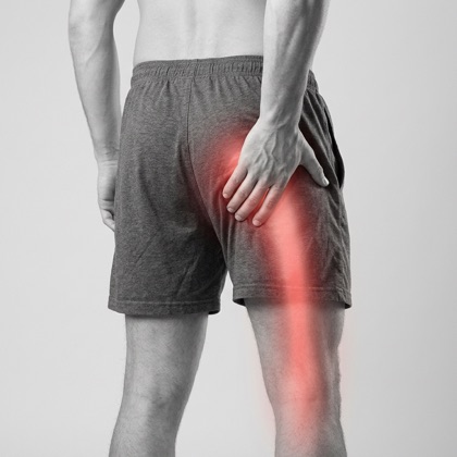 Red highlight tracing radiating sciatic nerve pain down the back of the leg